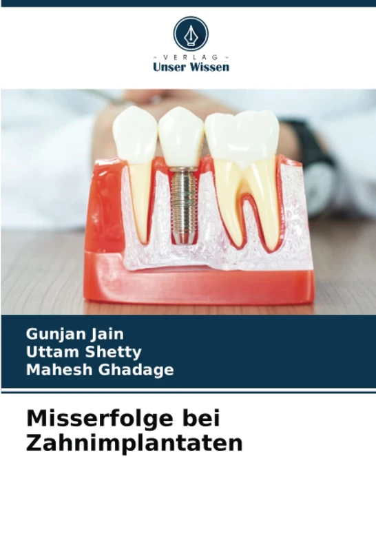 Misserfolge bei Zahnimplantaten