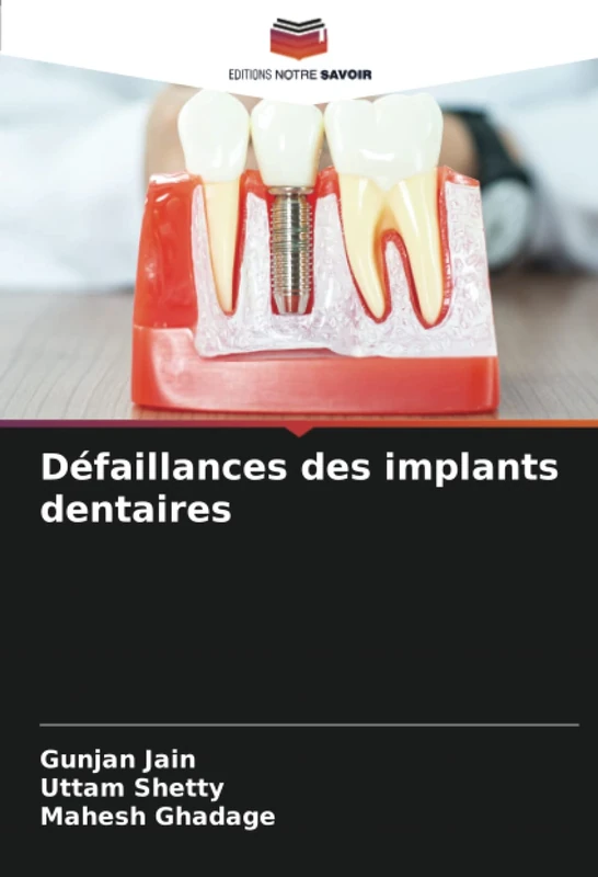 Défaillances des implants dentaires
