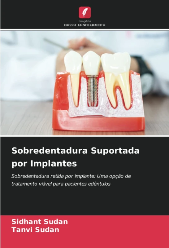 Sobredentadura Suportada por Implantes: Sobredentadura retida por implante: Uma opção de tratamento viável para pacientes edêntulos