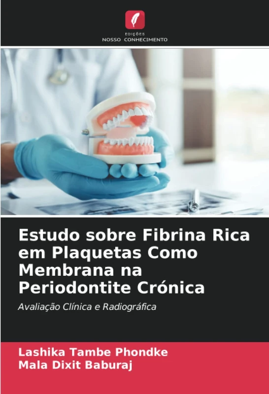 Estudo sobre Fibrina Rica em Plaquetas Como Membrana na Periodontite Crónica: Avaliação Clínica e Radiográfica - Image 1