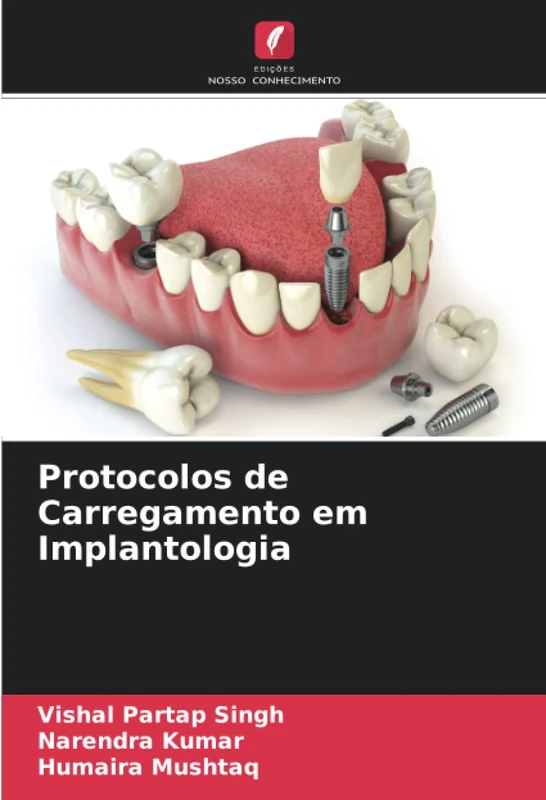 Protocolos de Carregamento em Implantologia