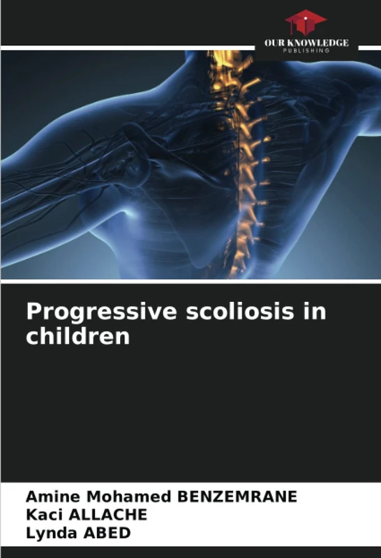 Progressive scoliosis in children - Image 1