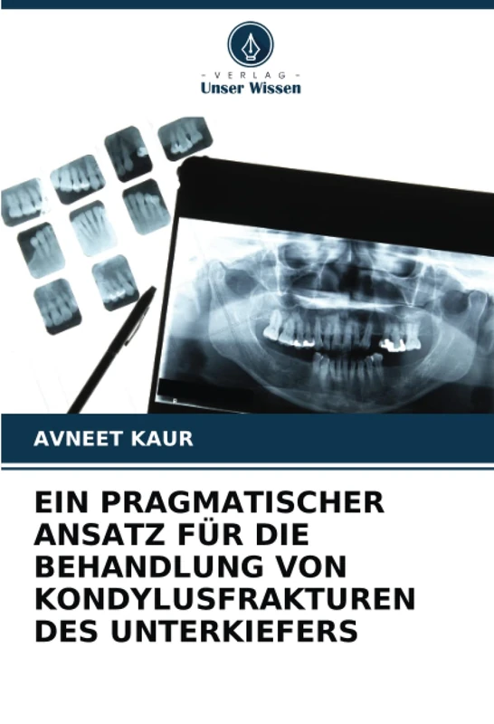 EIN PRAGMATISCHER ANSATZ FÜR DIE BEHANDLUNG VON KONDYLUSFRAKTUREN DES UNTERKIEFERS