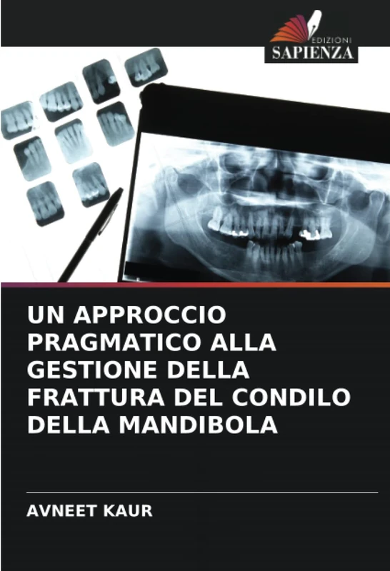 UN APPROCCIO PRAGMATICO ALLA GESTIONE DELLA FRATTURA DEL CONDILO DELLA MANDIBOLA