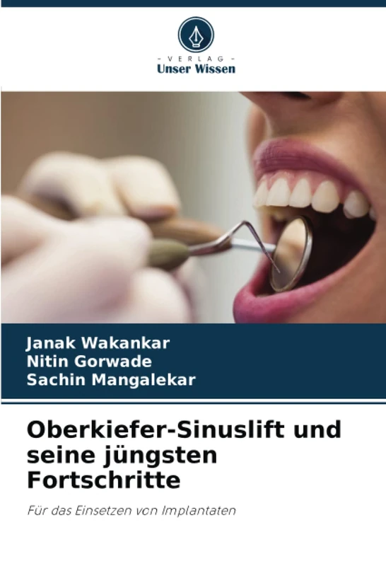 Oberkiefer-Sinuslift und seine jüngsten Fortschritte: Für das Einsetzen von Implantaten