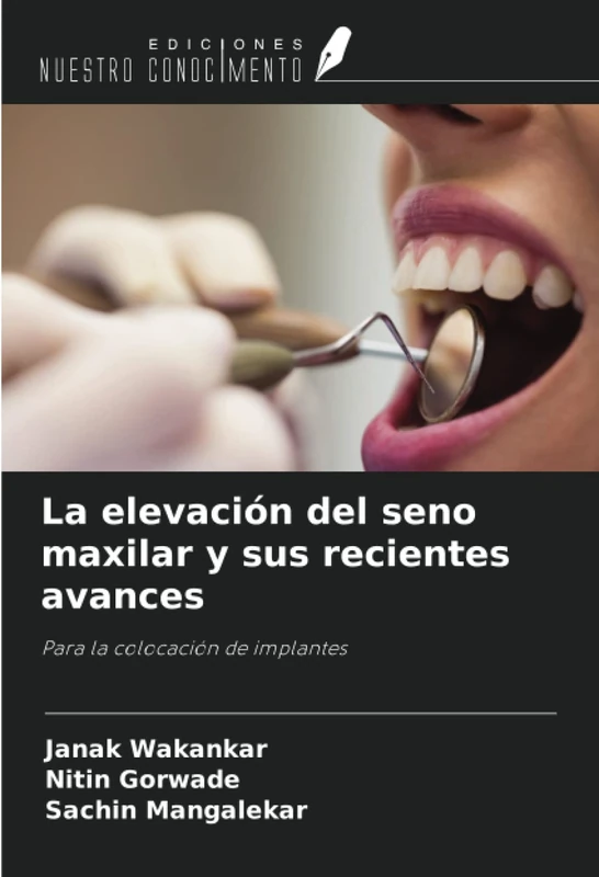La elevación del seno maxilar y sus recientes avances: Para la colocación de implantes