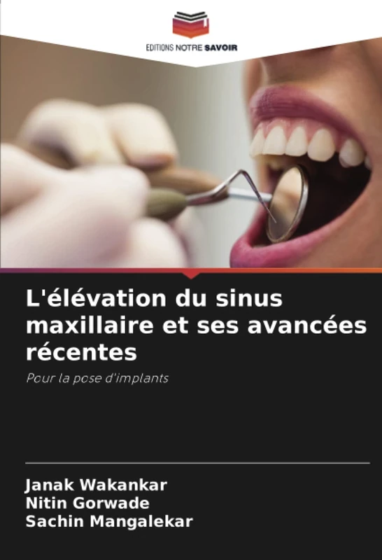 L'élévation du sinus maxillaire et ses avancées récentes: Pour la pose d'implants
