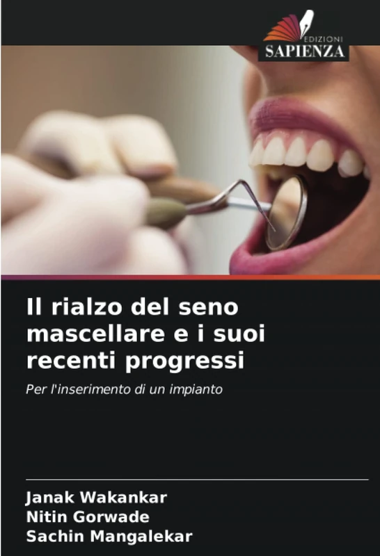 Il rialzo del seno mascellare e i suoi recenti progressi: Per l'inserimento di un impianto