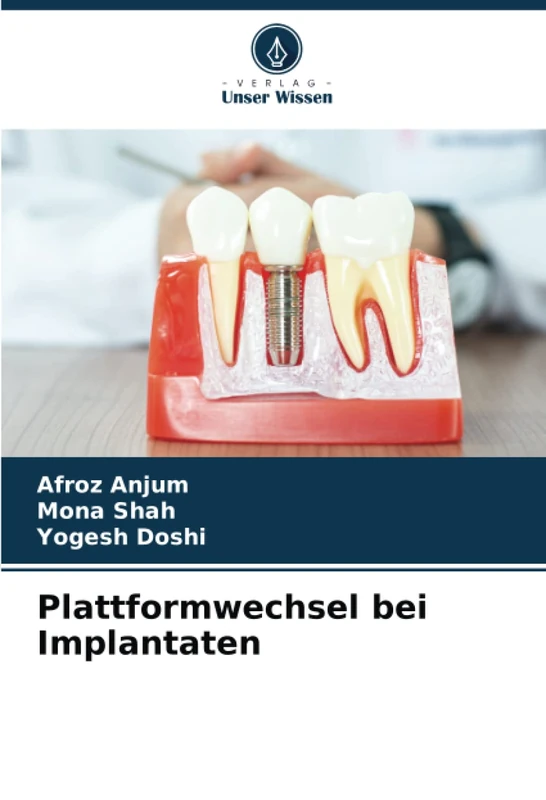 Plattformwechsel bei Implantaten