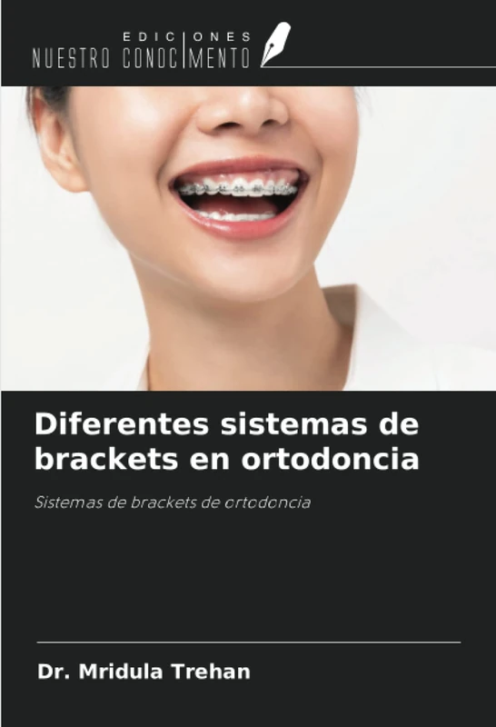 Diferentes sistemas de brackets en ortodoncia: Sistemas de brackets de ortodoncia