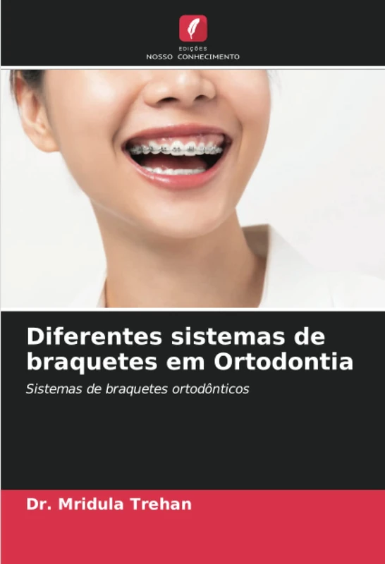 Diferentes sistemas de braquetes em Ortodontia: Sistemas de braquetes ortodônticos