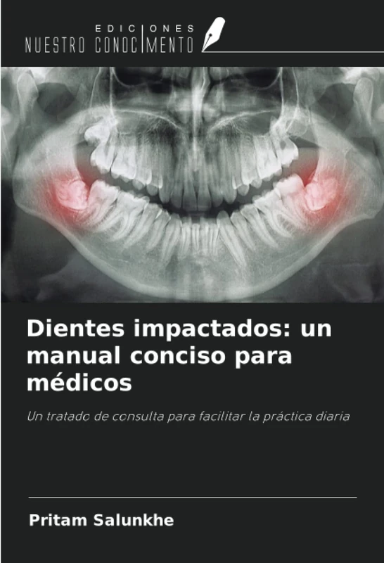 Dientes impactados: un manual conciso para médicos: Un tratado de consulta para facilitar la práctica diaria