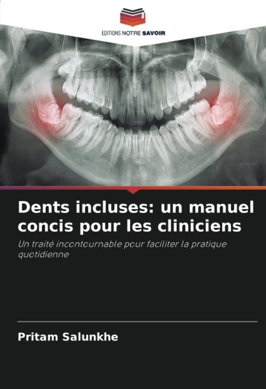 Dents incluses: un manuel concis pour les cliniciens: Un traité incontournable pour faciliter la pratique quotidienne