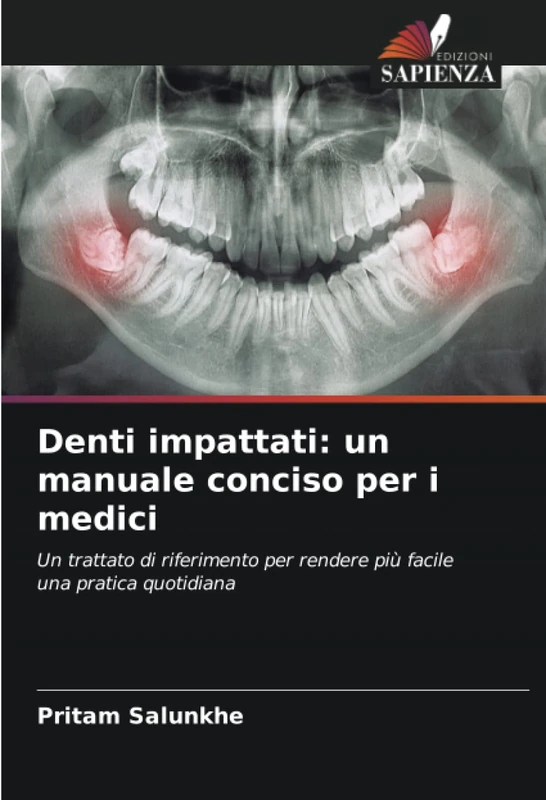 Denti impattati: un manuale conciso per i medici: Un trattato di riferimento per rendere più facile una pratica quotidiana