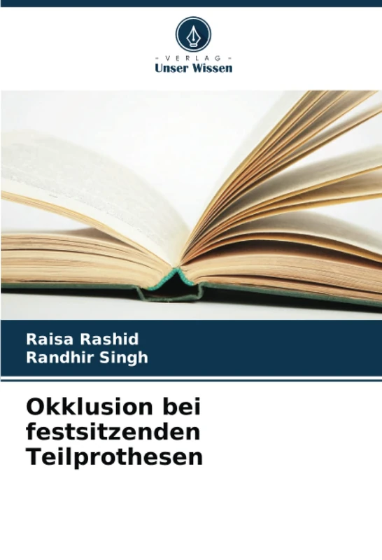 Okklusion bei festsitzenden Teilprothesen