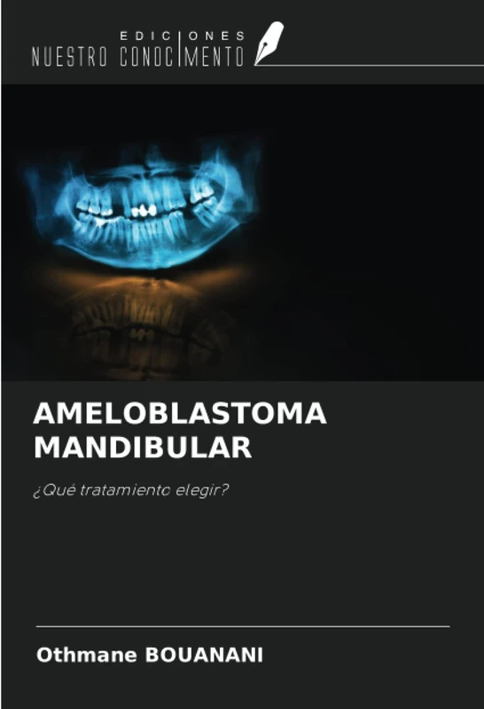 AMELOBLASTOMA MANDIBULAR: ¿Qué tratamiento elegir?