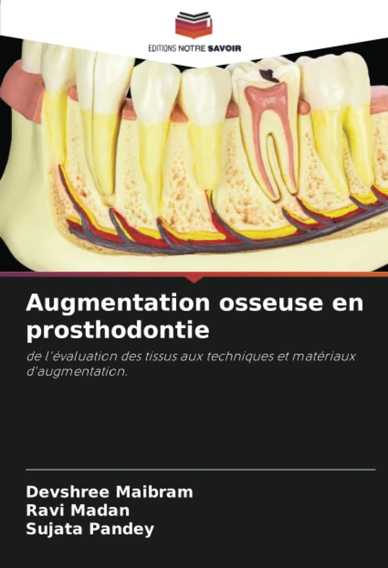 Augmentation osseuse en prosthodontie: de l'évaluation des tissus aux techniques et matériaux d'augmentation. - Image 1