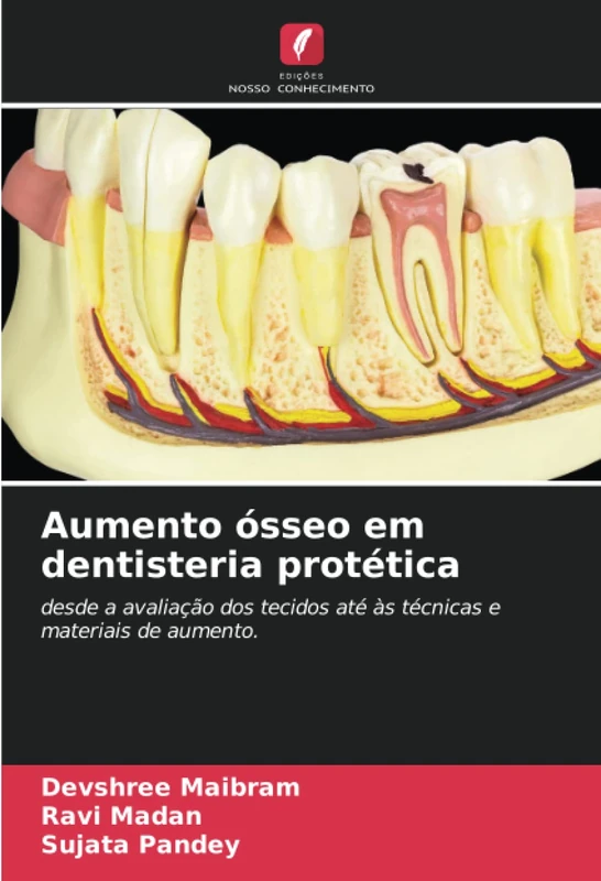 Aumento ósseo em dentisteria protética: desde a avaliação dos tecidos até às técnicas e materiais de aumento.