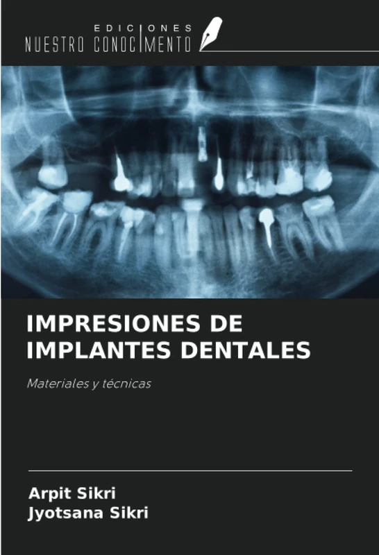 IMPRESIONES DE IMPLANTES DENTALES: Materiales y técnicas