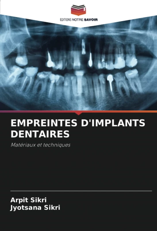 EMPREINTES D'IMPLANTS DENTAIRES: Matériaux et techniques
