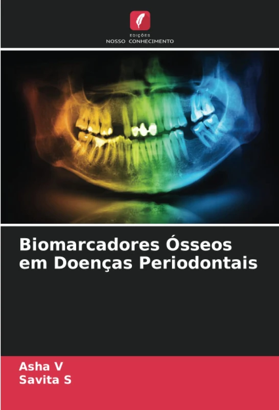 Biomarcadores Ósseos em Doenças Periodontais