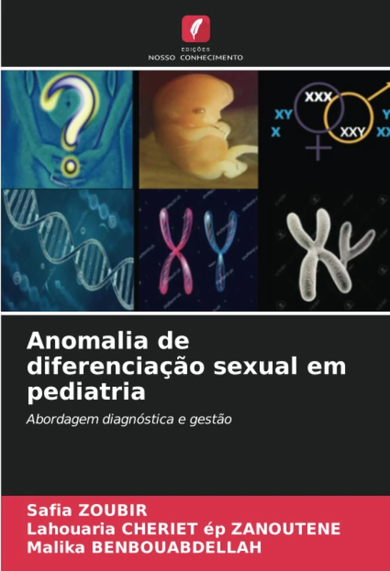 Anomalia de diferenciação sexual em pediatria: Abordagem diagnóstica e gestão