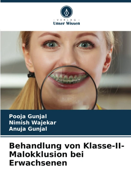 Behandlung von Klasse-II-Malokklusion bei Erwachsenen - Image 1