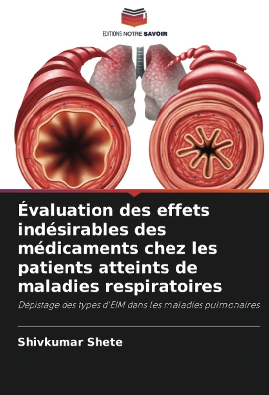 Évaluation des effets indésirables des médicaments chez les patients atteints de maladies respiratoires: Dépistage des types d'EIM dans les maladies pulmonaires
