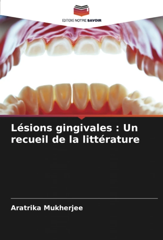 Lésions gingivales : Un recueil de la littérature - Image 1