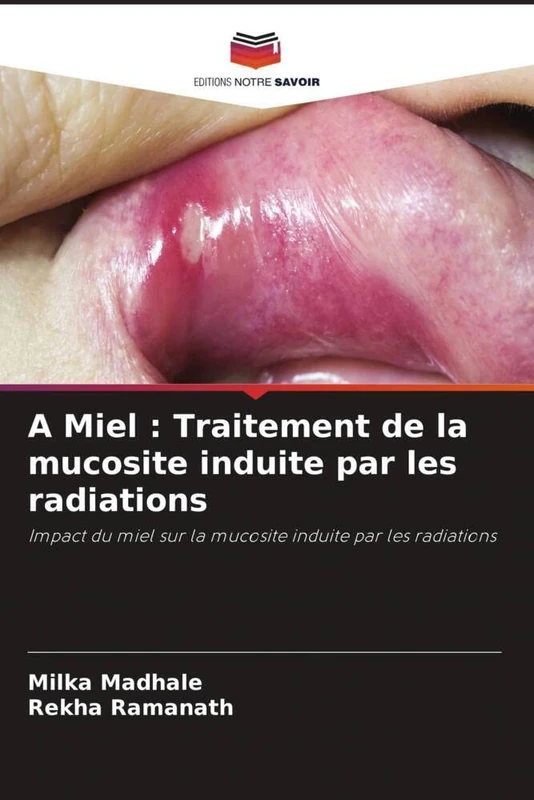 A Miel : Traitement de la mucosite induite par les radiations: Impact du miel sur la mucosite induite par les radiations - Image 1