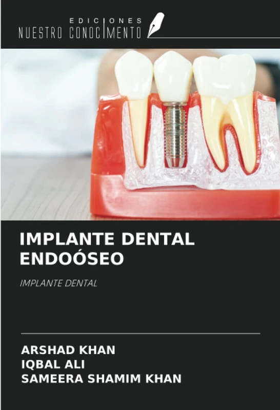 IMPLANTE DENTAL ENDOÓSEO: IMPLANTE DENTAL