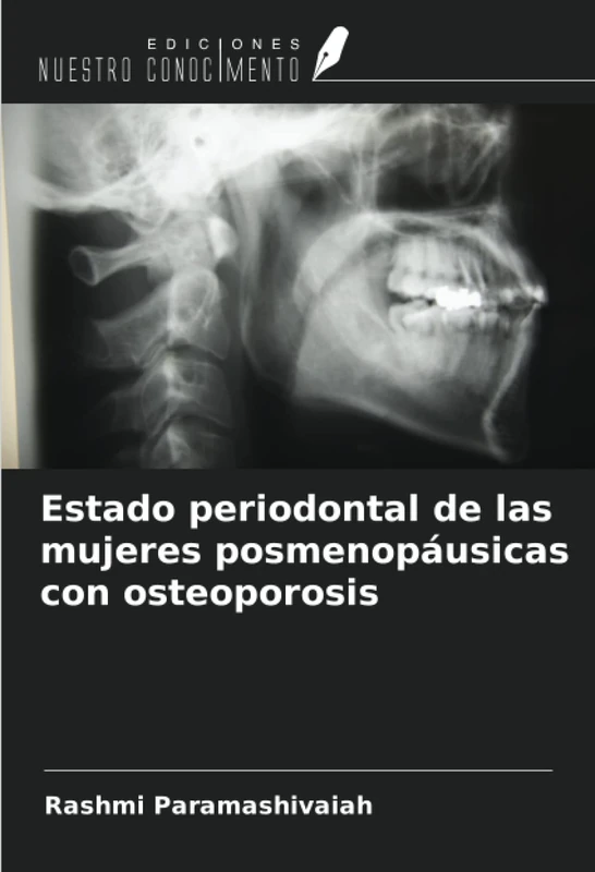 Estado periodontal de las mujeres posmenopáusicas con osteoporosis