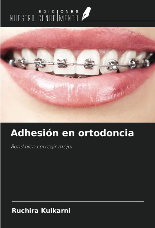 Adhesión en ortodoncia: Bond bien corregir mejor - Image 1