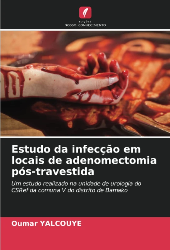 Estudo da infecção em locais de adenomectomia pós-travestida: Um estudo realizado na unidade de urologia do CSRef da comuna V do distrito de Bamako - Image 1