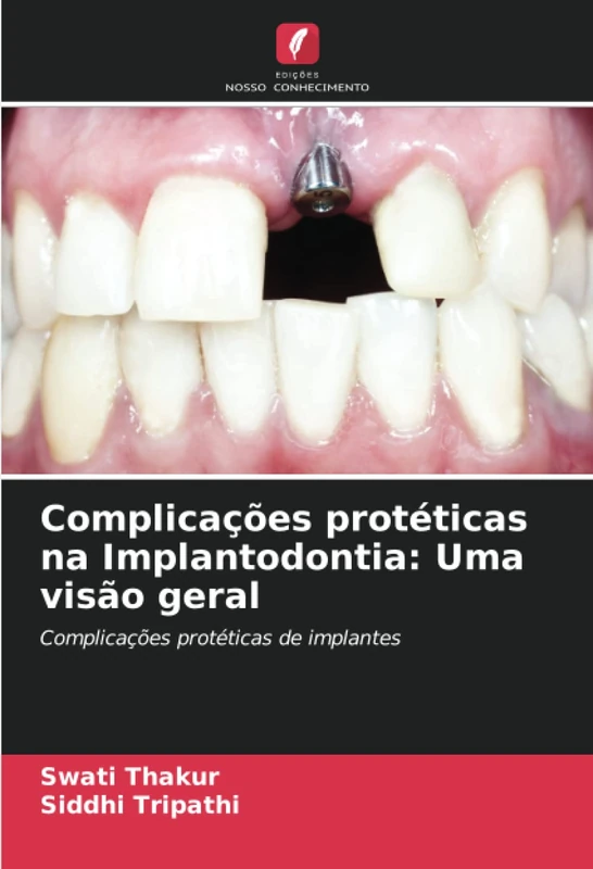 Complicações protéticas na Implantodontia: Uma visão geral: Complicações protéticas de implantes