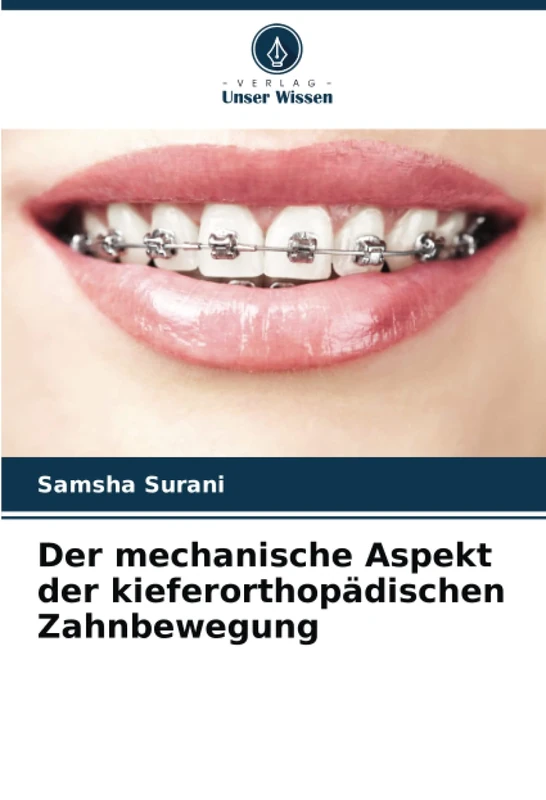 Der mechanische Aspekt der kieferorthopädischen Zahnbewegung