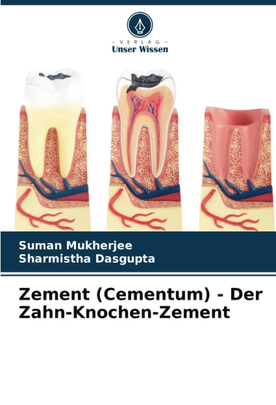 Zement (Cementum) - Der Zahn-Knochen-Zement - Image 1
