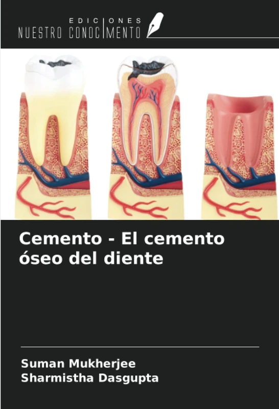 Cemento - El cemento óseo del diente - Image 1