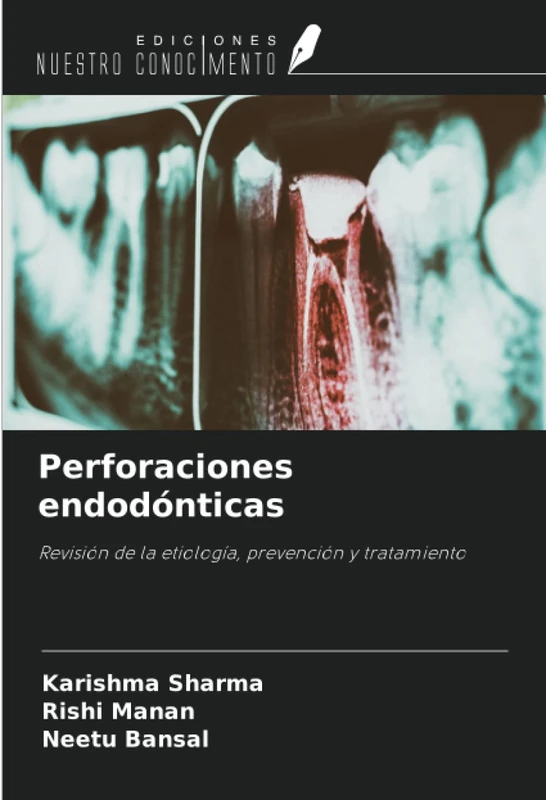 Perforaciones endodónticas: Revisión de la etiología, prevención y tratamiento - Image 1