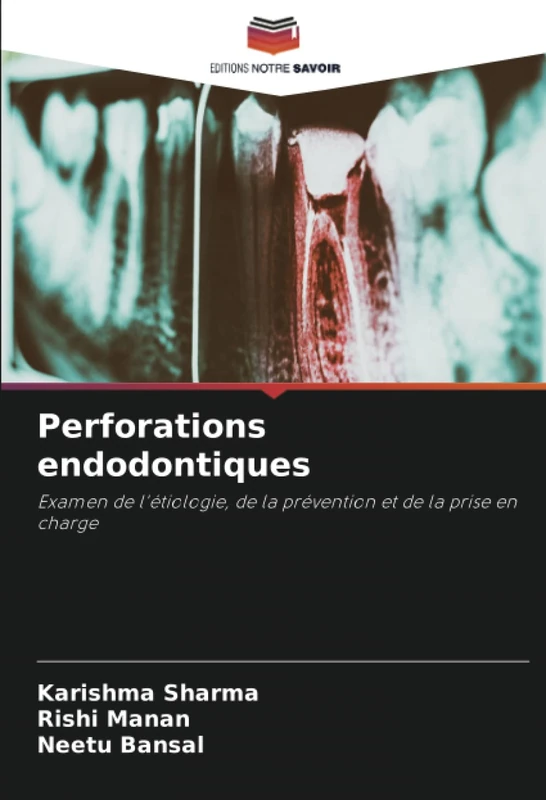 Perforations endodontiques: Examen de l'étiologie, de la prévention et de la prise en charge