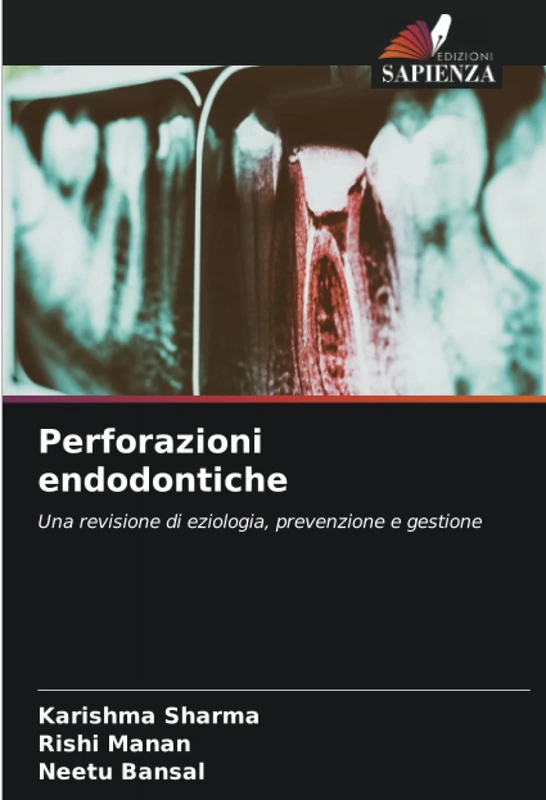 Perforazioni endodontiche: Una revisione di eziologia, prevenzione e gestione