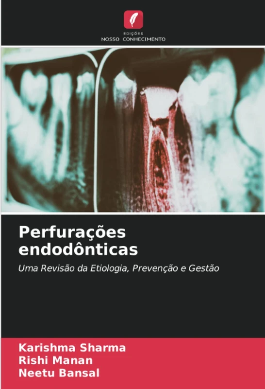 Perfurações endodônticas: Uma Revisão da Etiologia, Prevenção e Gestão