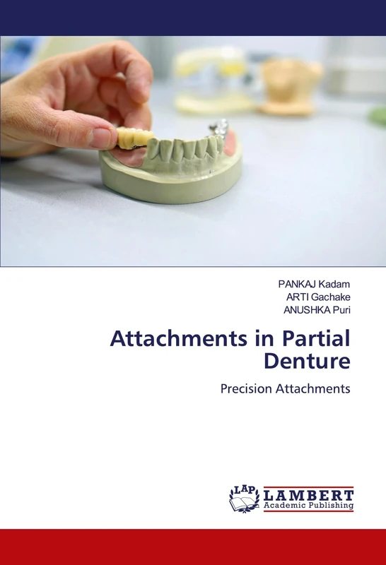Attachments in Partial Denture: Precision Attachments