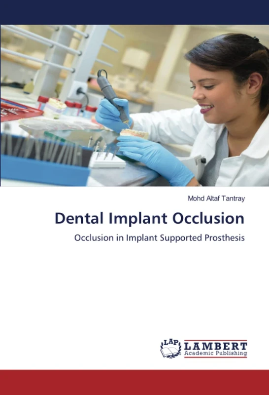 Dental Implant Occlusion: Occlusion in Implant Supported Prosthesis