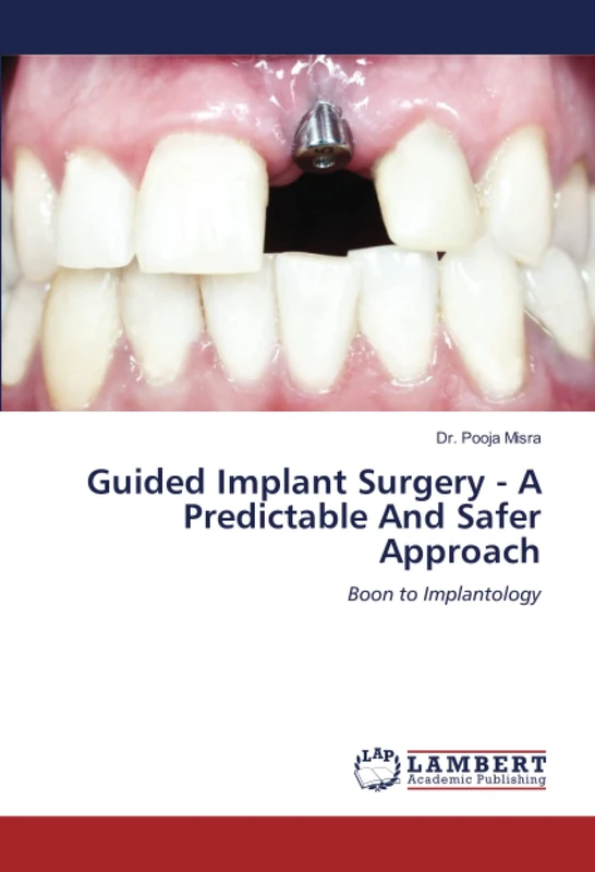 Guided Implant Surgery - A Predictable And Safer Approach: Boon to Implantology