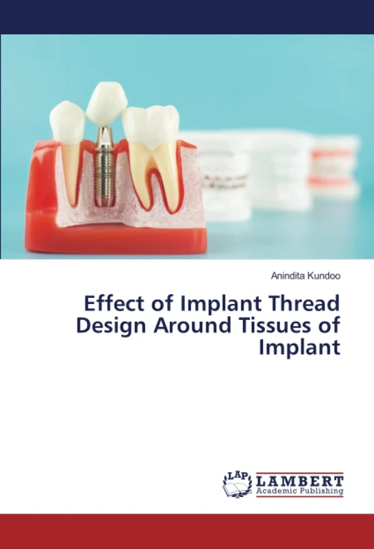 Effect of Implant Thread Design Around Tissues of Implant