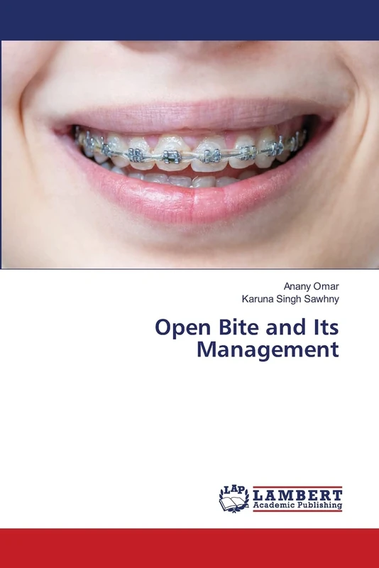 Open Bite and Its Management - Image 1