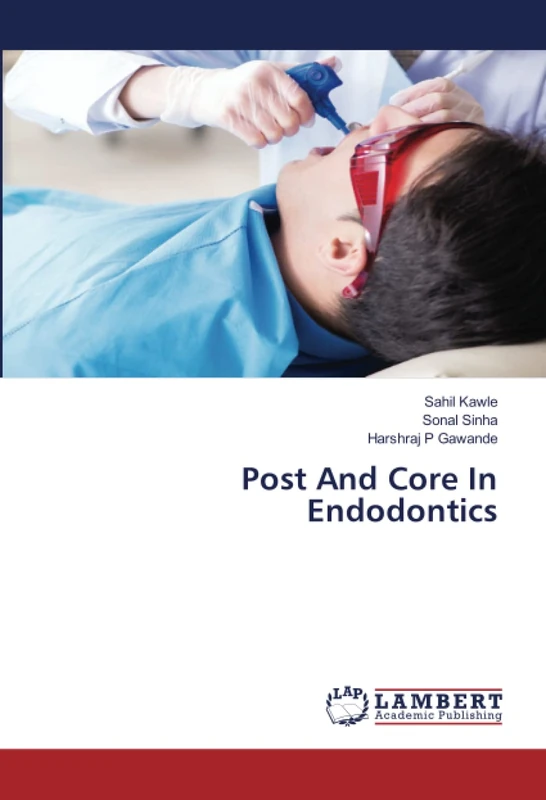 Post And Core In Endodontics - Image 1