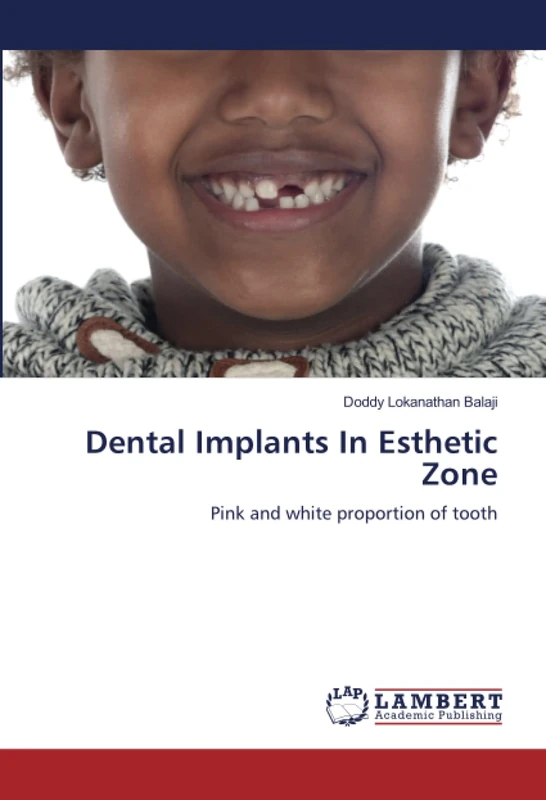 Dental Implants In Esthetic Zone: Pink and white proportion of tooth