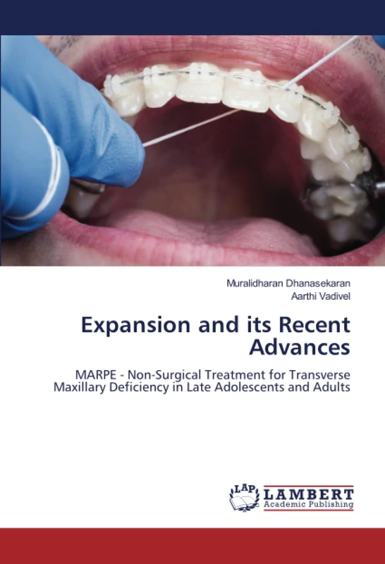 Expansion and its Recent Advances: MARPE - Non-Surgical Treatment for Transverse Maxillary Deficiency in Late Adolescents and Adults - Image 1